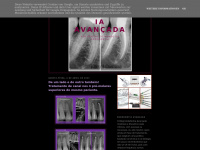 endodontiaavancada.blogspot.com