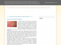 Dermatite-contacto.blogspot.com
