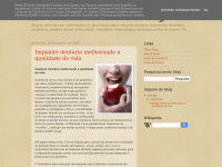 Implante-rio.blogspot.com